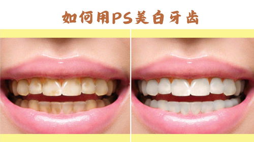 如何用PS美白牙齿