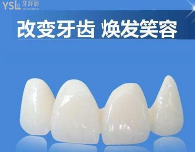全瓷牙品牌排行榜及价格(哪个品牌质量好),进来了解就晓得了