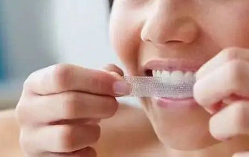 牙齿美白,哪些招最管用 哪些是瞎折腾