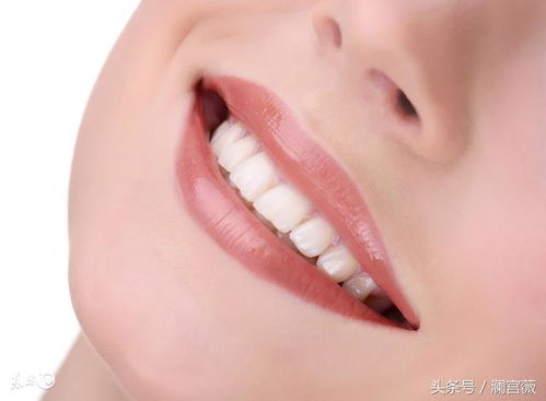 澜宫薇 如何美白牙齿 从这几个方法入手