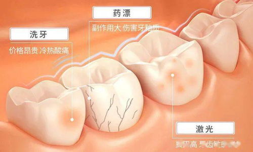 是什么 黑 科技护牙方式风靡全网 专业美白健齿,冷光牙贴成就一瞬亮白