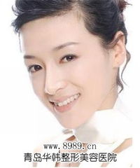 瑞兰玻尿酸注射除皱怎么样