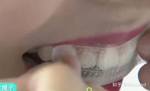 美白牙齿的牙贴,真的能够使我们的牙齿变白吗
