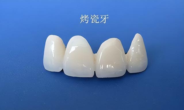 美白牙齿能恢复原本的白色,但需要时间,在美白前要做好准备工作