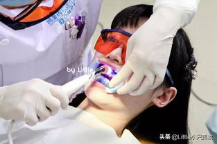 黄牙妹自救指南 这里有我用过最有效的牙齿美白产品