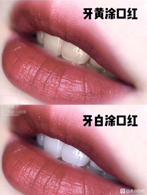 全瓷贴面工厂,诚邀合作。